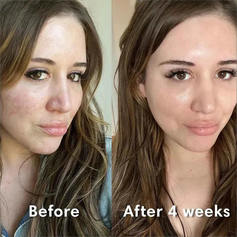 Cristal Lift™ – ¡¡2x1 en Mascarilla Coreana!!