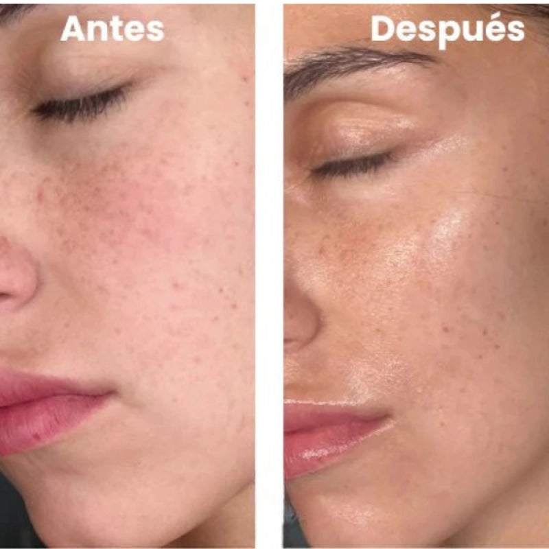 Cristal Lift™ – ¡¡2x1 en Mascarilla Coreana!!