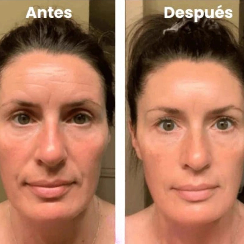 Cristal Lift™ – ¡¡2x1 en Mascarilla Coreana!!