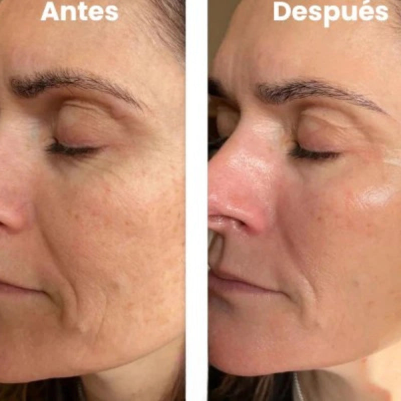 Cristal Lift™ – ¡¡2x1 en Mascarilla Coreana!!