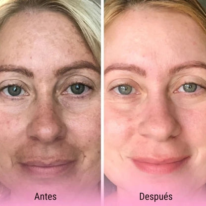 Discos Limpiadores y Exfoliantes de Cúrcuma y Ácido Kójico - ¡Llévate 2 por el precio de 1! 😍
