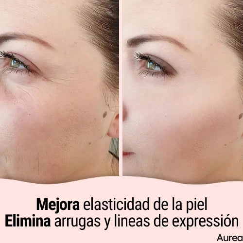 Discos Limpiadores y Exfoliantes de Cúrcuma y Ácido Kójico - ¡Llévate 2 por el precio de 1! 😍