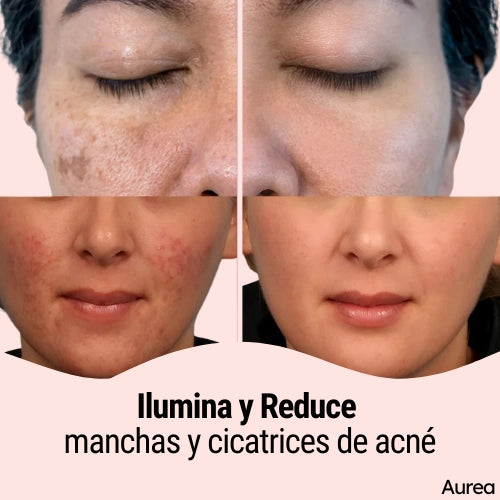 Discos Limpiadores y Exfoliantes de Cúrcuma y Ácido Kójico - ¡Llévate 2 por el precio de 1! 😍