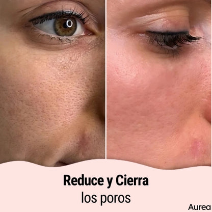 Discos Limpiadores y Exfoliantes de Cúrcuma y Ácido Kójico - ¡Llévate 2 por el precio de 1! 😍