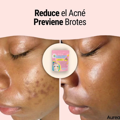Discos Limpiadores y Exfoliantes de Cúrcuma y Ácido Kójico - ¡Llévate 2 por el precio de 1! 😍