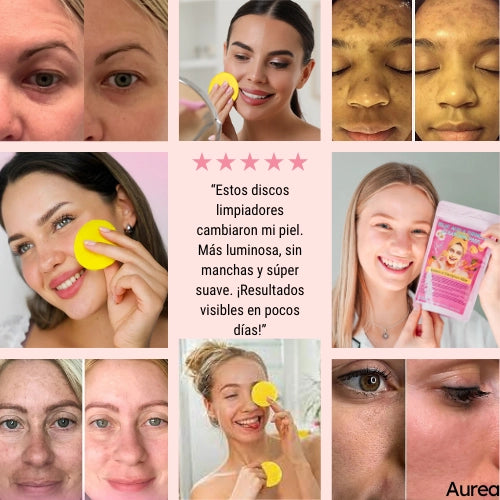 Discos Limpiadores y Exfoliantes de Cúrcuma y Ácido Kójico - ¡Llévate 2 por el precio de 1! 😍